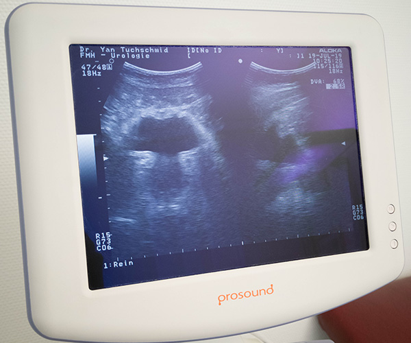 ultrasound device