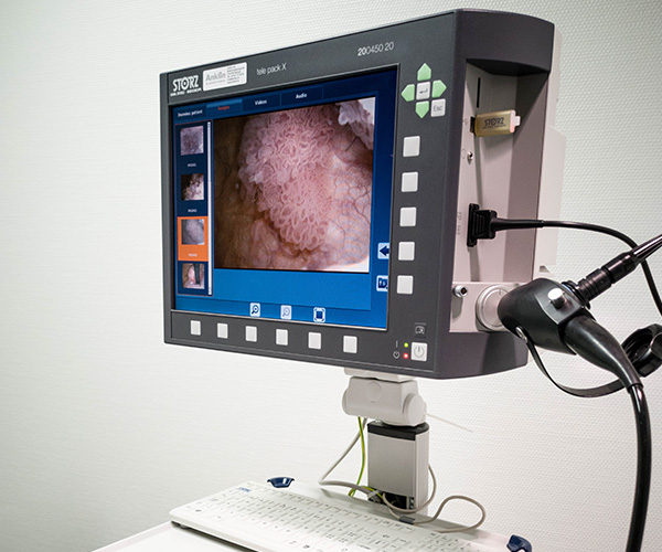 cystoscopes souples avec écran